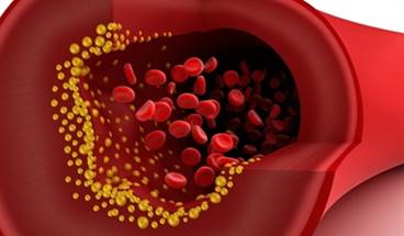 Dyslipidemia and Atherosclerosis Clinical Practice Guidelines Dyslipidemia and Atherosclerosis Clinical Practice Guidelines