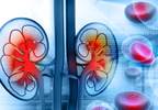 Both Genders Have Increased Stroke Risk With Elevated Serum Uric Acid Both Genders Have Increased Stroke Risk With Elevated Serum Uric Acid
