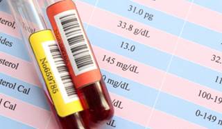 What are some of the dangers of having high triglyceride levels?