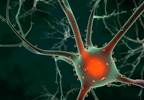 Dysglycemia Affects Cognition, Brain Structure in Older Adults Dysglycemia Affects Cognition, Brain Structure in Older Adults