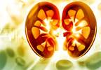 CV-Related Mortality Risk Increased With End-Stage Renal Disease and RA CV-Related Mortality Risk Increased With End-Stage Renal Disease and RA