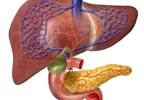Stroke Risk Increased With Cirrhosis Stroke Risk Increased With Cirrhosis