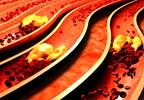 CVD Risk Management in Rheumatoid Arthritis: Updated Guidelines CVD Risk Management in Rheumatoid Arthritis: Updated Guidelines
