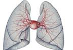Pulmonary Artery-to-Aorta Ratio May Predict Survival in Idiopathic Pulmonary Fibrosis Pulmonary Artery-to-Aorta Ratio May Predict Survival in Idiopathic Pulmonary Fibrosis