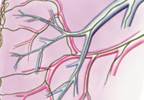 New Metabolites Associated With Hemodynamic Indicators of Right Ventricular-Pulmonary Vascular Dysfunction Discovered New Metabolites Associated With Hemodynamic Indicators of Right Ventricular-Pulmonary Vascular Dysfunction Discovered