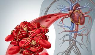 Patients taking apixaban were more likely to experience ischemic stroke or systemic embolism vs patients taking warfarin. Patients taking apixaban were more likely to experience ischemic stroke or systemic embolism vs patients taking warfarin.