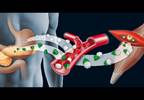 CVD Risk Predicted By Fasting Pancreatic Polypeptide in Type 2 Diabetes CVD Risk Predicted By Fasting Pancreatic Polypeptide in Type 2 Diabetes