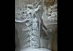 Case Study: Differential Diagnosis of Chest Pain With Radiation to the Neck Case Study: Differential Diagnosis of Chest Pain With Radiation to the Neck