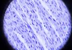 Metformin May Prevent Apoptotic Events Prior to Ischemic Reperfusion Injury Metformin May Prevent Apoptotic Events Prior to Ischemic Reperfusion Injury