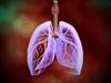Pulmonary Complications After Noncardiac Surgery Ameliorated By Pulmonary Rehab Pulmonary Complications After Noncardiac Surgery Ameliorated By Pulmonary Rehab