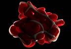 Hypercoagulability in Sleep Apnea Can Increase Risk for CV Complications Hypercoagulability in Sleep Apnea Can Increase Risk for CV Complications