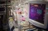 Bronchopulmonary Dysplasia and Pulmonary Hypertension in Preterm Neonates Bronchopulmonary Dysplasia and Pulmonary Hypertension in Preterm Neonates