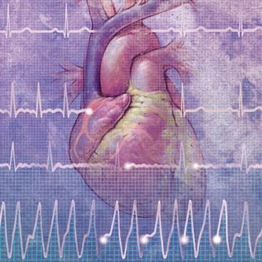 "Lone" Atrial Fibrillation: Finding Optimal Treatment Strategies "Lone" Atrial Fibrillation: Finding Optimal Treatment Strategies