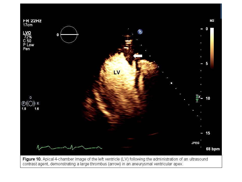 Use of the Echocardiogram to Define the Presence, Extent, and Etiology of Cardiac Dysfunction