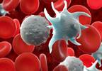 Fostamatinib Seems Effective for Immune Thrombocytopenia Fostamatinib Seems Effective for Immune Thrombocytopenia