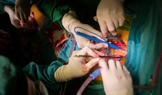 From 2004 to 2012, the incidence of AKI increased from 4.9% to 14.2% among CABG patients and from 2.7% to 8.8% among PCI patients. From 2004 to 2012, the incidence of AKI increased from 4.9% to 14.2% among CABG patients and from 2.7% to 8.8% among PCI patients.