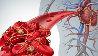 Three metabolic abnormalities — diabete,s hypertension, and hyperlipidemia — were examined. Three metabolic abnormalities — diabete,s hypertension, and hyperlipidemia — were examined.