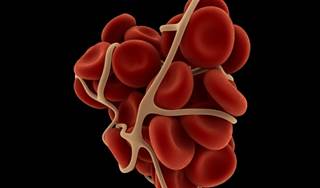 Patients who took enoxaparin once daily had few major bleeds compared with patients who took enoxaparin twice daily. Patients who took enoxaparin once daily had few major bleeds compared with patients who took enoxaparin twice daily.