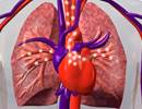 MRIs Can Predict Outcomes in Pulmonary Arterial Hypertension MRIs Can Predict Outcomes in Pulmonary Arterial Hypertension