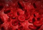 BARC Bleeding Criteria Effectively Predict Mortality in Acute Coronary Syndromes Without STE BARC Bleeding Criteria Effectively Predict Mortality in Acute Coronary Syndromes Without STE