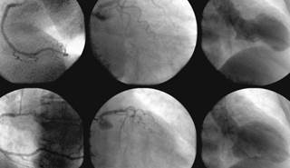 During the 28-day study period, patients who underwent clinical evaluation alone experienced a shorter LOS. During the 28-day study period, patients who underwent clinical evaluation alone experienced a shorter LOS.