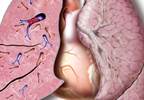 Necessity of Pulmonary Embolism Evaluation in Syncope Necessity of Pulmonary Embolism Evaluation in Syncope