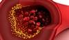 Dyslipidemia and Atherosclerosis Clinical Practice Guidelines Dyslipidemia and Atherosclerosis Clinical Practice Guidelines