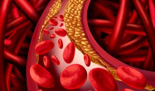 Tumor necrosis factor-α inhibiting drugs were shown to reduce the risk of myocardial infarction in rheumatoid arthritis. Tumor necrosis factor-α inhibiting drugs were shown to reduce the risk of myocardial infarction in rheumatoid arthritis.