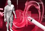 LV End-Diastolic Volume Index Did Not Change With Bioresorbable Cardiac Matrix LV End-Diastolic Volume Index Did Not Change With Bioresorbable Cardiac Matrix