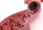Ticagrelor 60 and 90 mg Doses Achieve Similar Peak Levels of Platelet Inhibition Ticagrelor 60 and 90 mg Doses Achieve Similar Peak Levels of Platelet Inhibition