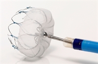 Watchman Device Linked to Low Complications, Successful Procedures