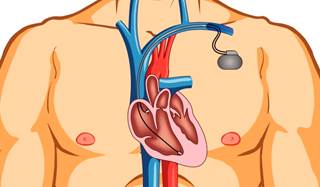 Revised process will ensure new medical devices meet safety and effectiveness standards Revised process will ensure new medical devices meet safety and effectiveness standards