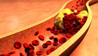 There were 57 CHD events and 108 incident CVD events during follow-up. There were 57 CHD events and 108 incident CVD events during follow-up.
