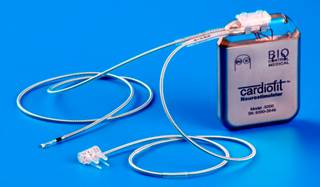 A vagus nerve stimulation device was implanted in half of the study participants to assess the benefit on chronic arm weakness. A vagus nerve stimulation device was implanted in half of the study participants to assess the benefit on chronic arm weakness.