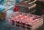 Ixmyelocel-T Cell-Based Therapy Reduced Cardiac Events in Heart Failure Ixmyelocel-T Cell-Based Therapy Reduced Cardiac Events in Heart Failure