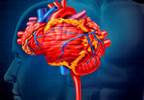 VIDEO: Major Bleeding in Patients with Atrial Fibrillation and Diabetes Taking Rivaroxaban VIDEO: Major Bleeding in Patients with Atrial Fibrillation and Diabetes Taking Rivaroxaban