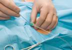 Appropriate Use Criteria Application Reduces Percutaneous Coronary Intervention Incidence Appropriate Use Criteria Application Reduces Percutaneous Coronary Intervention Incidence