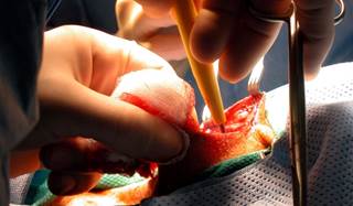 Higher odds of CAS were seen in association with symptomatic stenosis, congestive heart failure, and peripheral vascular disease. Higher odds of CAS were seen in association with symptomatic stenosis, congestive heart failure, and peripheral vascular disease.