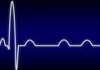 Biventricular Pacing Superior to Right Ventricular Pacing in Patients With Atrioventricular Block Biventricular Pacing Superior to Right Ventricular Pacing in Patients With Atrioventricular Block