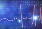 Catheter Ablation vs Antiarrhythmic Drug Escalation Therapy in Patients With Ventricular Tachycardia Catheter Ablation vs Antiarrhythmic Drug Escalation Therapy in Patients With Ventricular Tachycardia