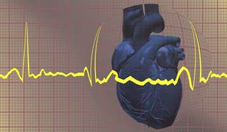 Prior to starting antipsychotic therapy, pediatric patients should undergo a baseline electrocardiogram assessment. Prior to starting antipsychotic therapy, pediatric patients should undergo a baseline electrocardiogram assessment.
