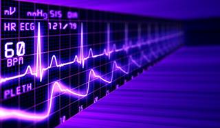 Sudden cardiac arrests decreased among middle-aged people as coverage expanded. Sudden cardiac arrests decreased among middle-aged people as coverage expanded.