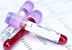 Glucose Levels May Affect Functional Outcomes After Endovascular Thrombectomy Glucose Levels May Affect Functional Outcomes After Endovascular Thrombectomy