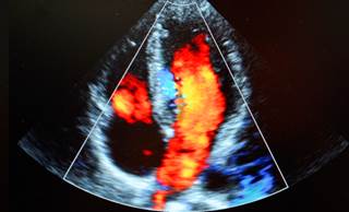 Baseline LF-HRV was significantly positively associated with baseline levels of IL-10 in the MDD group only. Baseline LF-HRV was significantly positively associated with baseline levels of IL-10 in the MDD group only.