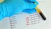 PCSK9 Inhibitor Tolerability Examined in Patients With Self-Reported Statin Intolerance PCSK9 Inhibitor Tolerability Examined in Patients With Self-Reported Statin Intolerance