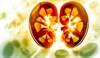 Chronic Kidney Disease Benefits From Intensive Blood Pressure Reductions Chronic Kidney Disease Benefits From Intensive Blood Pressure Reductions