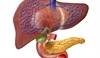 Stroke Risk Increased With Cirrhosis Stroke Risk Increased With Cirrhosis