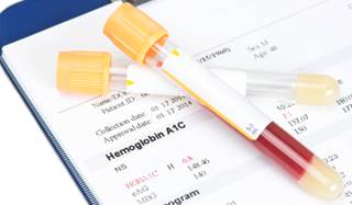 Patients with diabetes represent more than a quarter of patients undergoing PCI. Patients with diabetes represent more than a quarter of patients undergoing PCI.