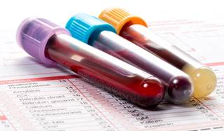 Postprandial hyperglycemia was associated with CVD incidence independent of mean HbA1c levels. Postprandial hyperglycemia was associated with CVD incidence independent of mean HbA1c levels.