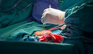 There was a correlation between lower use of medical therapy and adverse clinical outcomes in PCI vs CABG at 5 years. There was a correlation between lower use of medical therapy and adverse clinical outcomes in PCI vs CABG at 5 years.